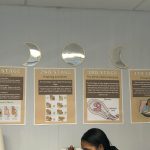 Educational wall posters showing the four stages of labor, labeled “1st Stage” to “4th Stage,” with illustrations of fetal descent and birthing positions.