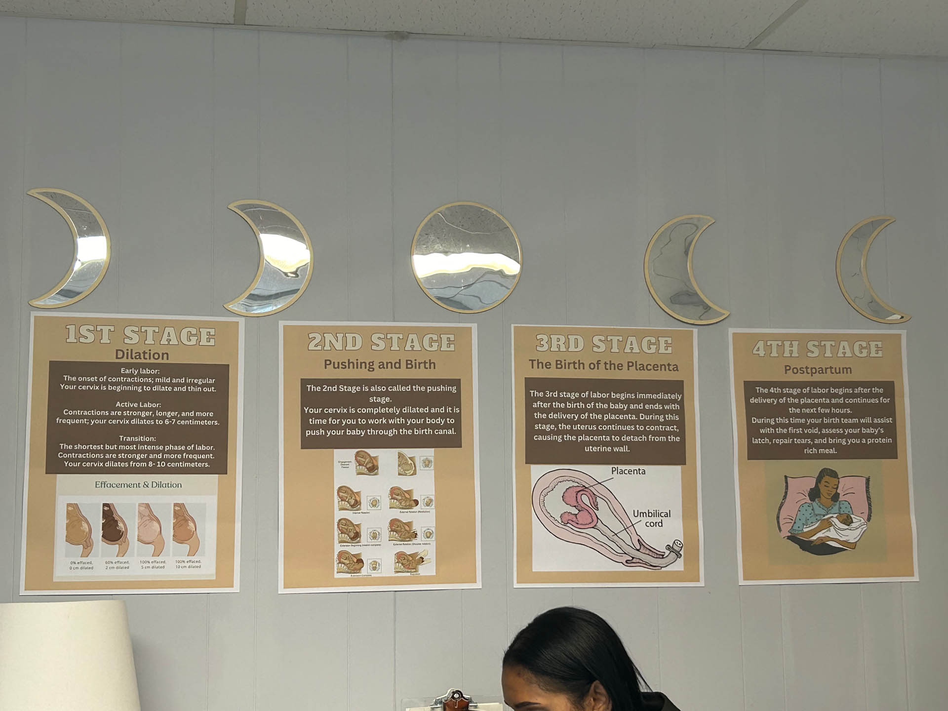 Educational wall posters showing the four stages of labor, labeled “1st Stage” to “4th Stage,” with illustrations of fetal descent and birthing positions.